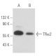 TRα2 Antibody (1330) - Western Blotting - Image 17183
