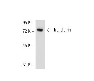 transferrin Antibody (11D3) - Western Blotting - Image 52350