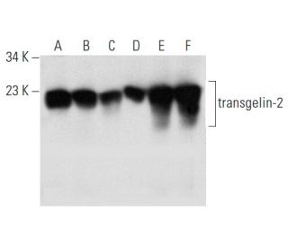 transgelin-2 Antibody (C-12) - Western Blotting - Image 357264 