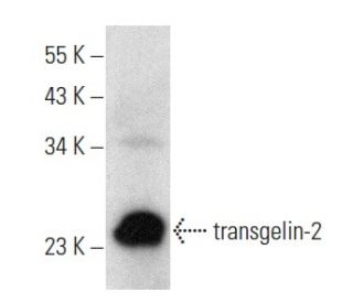transgelin-2 Antibody (G-5) - Western Blotting - Image 357006 