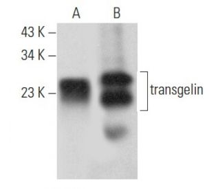 transgelin Antibody (C-11) - Western Blotting - Image 358072 