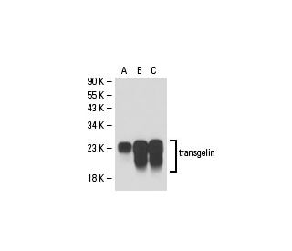 western blotting image from recommended transgelin (6G6) monoclonal antibody replacement. Image 18033