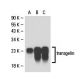 Este anticorpo policlonal foi descontinuado. Consulta o nosso anticorpo monoclonal <a href="transgelin-antibody-6g6">transgelin (6G6)</a> recomendado (dados de amostra apresentados). western blotting image from recommended transgelin (6G6) monoclonal antibody replacement. Image 18033