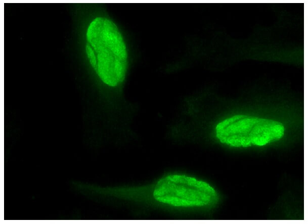 しもとページ Integrin β3/ITGB3/CD61 Antibody (D-11) | SCBT - Santa Cruz