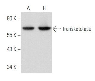 Transketolase Antibody (H-7) - Western Blotting - Image 356865 