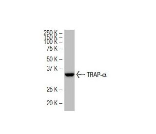TRAP-&alpha; Antibody (41-Q) - Western Blotting - Image 33690 
