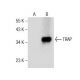 TRAP Antibody (D-3) - Western Blotting - Image 160873 