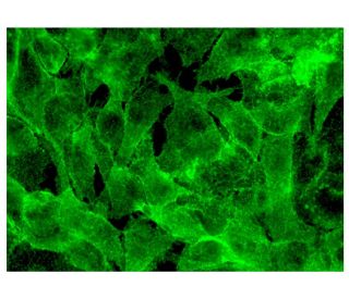 immunofluorescence image from recommended TRAP (D-3) monoclonal antibody replacement. Image 300869