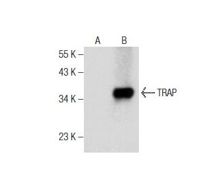 TRAP Antibody (D-3) - Western Blotting - Image 160873The Double Nickase Plasmid features a U6 promoter for sgRNA expression, a 20 nt targeting sequence, and a gRNA scaffold to guide Cas9n. It includes a CBh promoter for Cas9n (D10A) and puromycin resistance, GFP for transfection verification, and nuclear localization signals (NLS). The 2A peptide allows co-expression of Cas9n and Puro from a single promoter, enabling precise genome editing with reduced off-target effects.