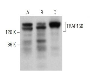 western blotting image from recommended TRAP150 (F-10) monoclonal antibody replacement. Image 374850