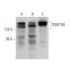 western blotting image from recommended TRAP150 (F-10) monoclonal antibody replacement. Image 374850