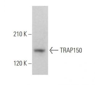 TRAP150 Antibody (F-10) - Western Blotting - Image 374855The Double Nickase Plasmid features a U6 promoter for sgRNA expression, a 20 nt targeting sequence, and a gRNA scaffold to guide Cas9n. It includes a CBh promoter for Cas9n (D10A) and puromycin resistance, GFP for transfection verification, and nuclear localization signals (NLS). The 2A peptide allows co-expression of Cas9n and Puro from a single promoter, enabling precise genome editing with reduced off-target effects.
