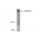 TRAP220 Antibody (B-4) - Western Blotting - Image 333445