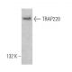 This polyclonal antibody has been discontinued. See our recommended <a href="trap220-antibody-h-7">TRAP220 (H-7)</a> monoclonal antibody (sample data shown). western blotting image from recommended TRAP220 (H-7) monoclonal antibody replacement. Image 355300
