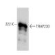 This polyclonal antibody has been discontinued. See our recommended <a href="trap230-antibody-e-2">TRAP230 (E-2)</a> monoclonal antibody (sample data shown). western blotting image from recommended TRAP230 (E-2) monoclonal antibody replacement. Image 358538