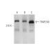 western blotting image from recommended TRAP240 (E-12) monoclonal antibody replacement. Image 350846