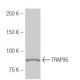 TRAP95 Antibody (F83) - Western Blotting - Image 54004 
