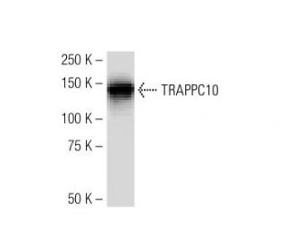 TRAPPC10 Antibody (RR-18) - Western Blotting - Image 34618Each CRISPR/Cas9 Knockout (KO) Plasmid product consists of a pool of 3 plasmids designed to ensure identification and cleavage of a specific gene for maximum knockout efficiency. Each plasmid encodes a unique 20 nt sequence derived from the GeCKO (v2) library.