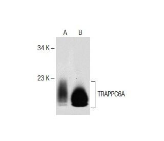 TRAPPC6A Antibody (G-5) - Western Blotting - Image 151744 