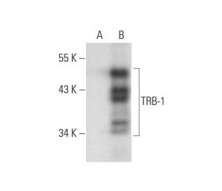 TRB-1 Antibody (E-7) - Western Blotting - Image 296280