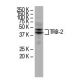 TRB-2 Antibody (B-06) - Western Blotting - Image 34250 