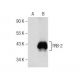 TRB-2 Antibody (F-5) - Western Blotting - Image 159011