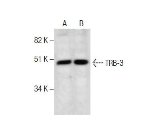 TRB-3 Antibody (B-2) - Western Blotting - Image 287591 