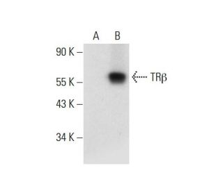 TR&beta;1 Antibody (A-7) - Western Blotting - Image 300432 