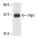 TRβ1 Antibody (A-7) - Western Blotting - Image 411238