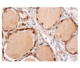 TR&beta;1 Antibody (J51) - Immunohistochemistry - Image 156768 