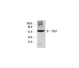 TR beta 1 Antibody (J52)
