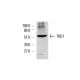 TRβ1 Antibody (J52) - Western Blotting - Image 1665 