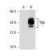 TRβ1 Antibody (J52) - Western Blotting - Image 154021