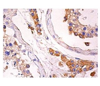 TRC8 Antibody (E-12) - Immunohistochemistry - Image 157917 