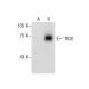 TRC8 Antibody (H-9) - Western Blotting - Image 287816