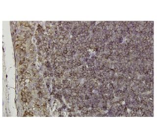 TRC8 Antibody (YB-16) - Immunohistochemistry - Image 36297 