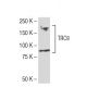 TRC8 Antibody (YB-16) - Western Blotting - Image 34477 
