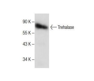 Trehalase Antibody (D-2) - Western Blotting - Image 286061 