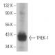 TREK-1 Antibody (F-6) - Western Blotting - Image 368324