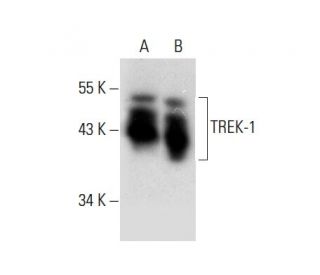 western blotting image from recommended TREK-1 (F-6) monoclonal antibody replacement. Image 304476