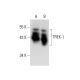 western blotting image from recommended TREK-1 (F-6) monoclonal antibody replacement. Image 304476