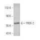 TREK-2 Antibody (1C1) - Western Blotting - Image 384455 