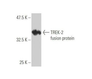 western blotting image from recommended TREK-2 (1C1) monoclonal antibody replacement. Image 349588