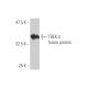 western blotting image from recommended TREK-2 (1C1) monoclonal antibody replacement. Image 349588