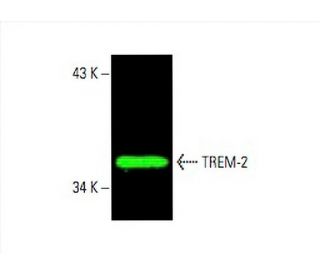 TREM-2 Antibody (B-3) - Western Blotting - Image 392410SAM Transcription Activation: SAM system utilizing dCas9-VP64, MS2-P65-HSF1, and sgRNA for precise gene transcription activation.