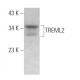 TREML2 Antibody (E-12) - Western Blotting - Image 371863