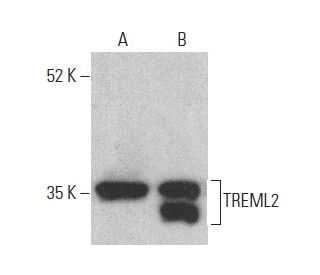 TREML2 Antibody (G-12) - Western Blotting - Image 400941 