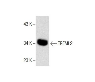 TREML2 Antibody (G-12) - Western Blotting - Image 287852