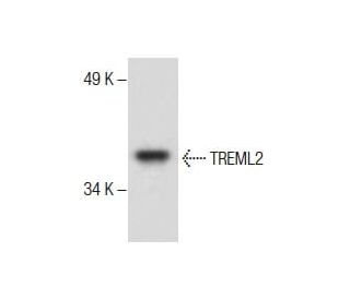 TREML2 Antibody (A-5) - Western Blotting - Image 287216