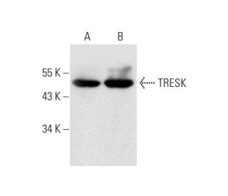 TRESK Antibody (E-2) - Western Blotting - Image 323810 